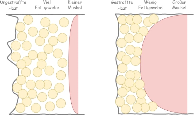 Haut strafen, Cellulite verhindern